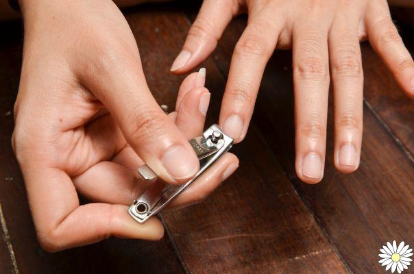 Morderse las uñas: 6 formas de dejar de hacerlo