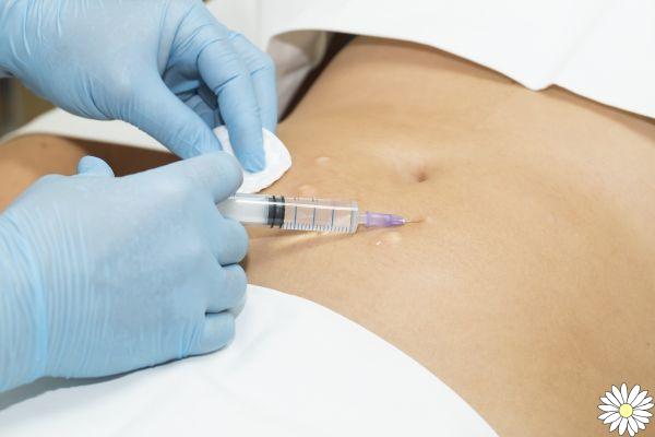 Mesotherapy: what it is, what is it for, benefits, costs, contraindications and side effects