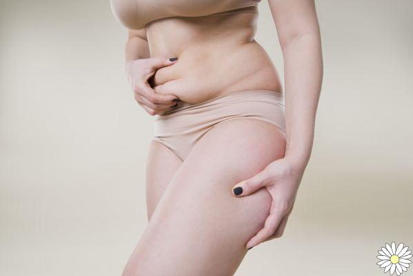 Loose skin: why, causes and how to firm up the skin after the diet and beyond