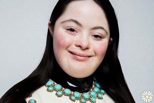 Ellie Goldstein, an unconventional beauty for Gucci: the model with Down syndrome is the new beauty testimonial